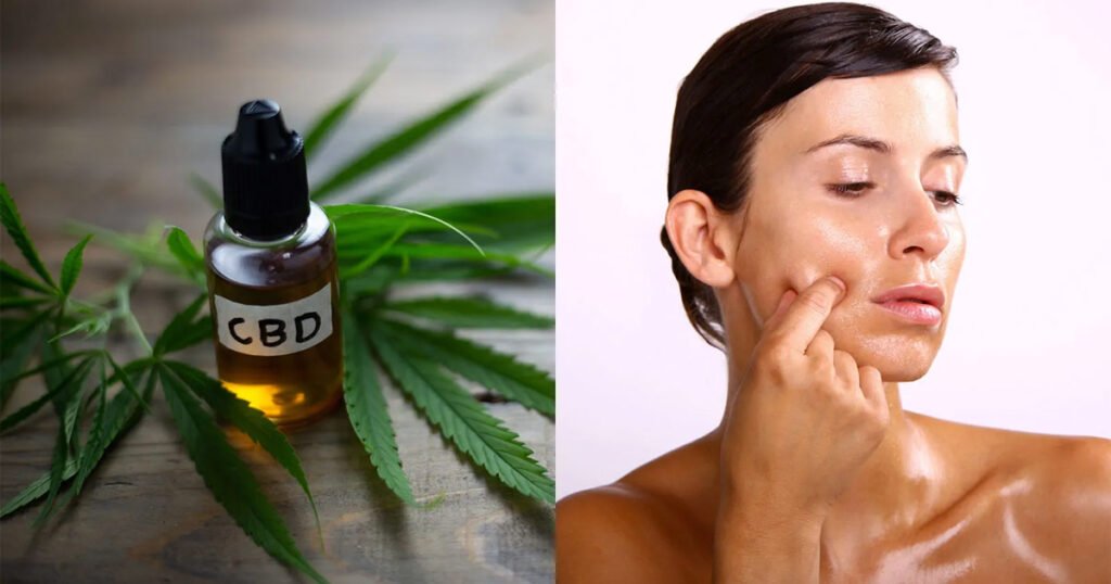 Benefits of CBD products in Vaughan, Canada